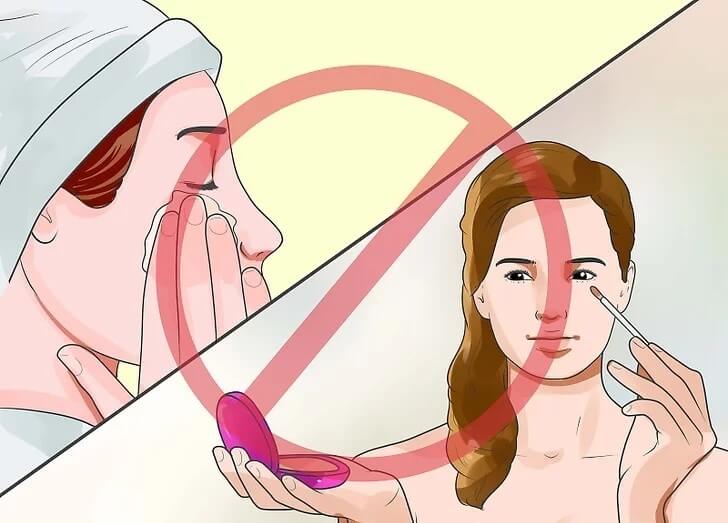Cách chăm sóc mắt sau phẫu thuật tại nhà