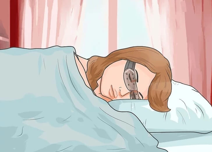 Cách chăm sóc mắt sau phẫu thuật tại nhà