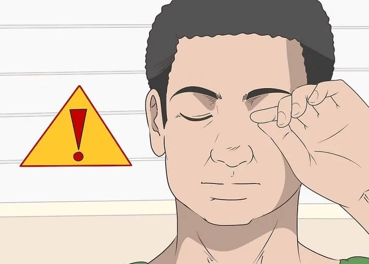 Cách chữa lành mắt chảy máu tại nhà