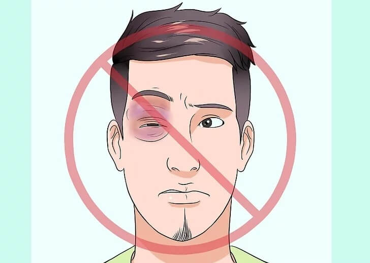 Cách điều trị mắt thâm đen