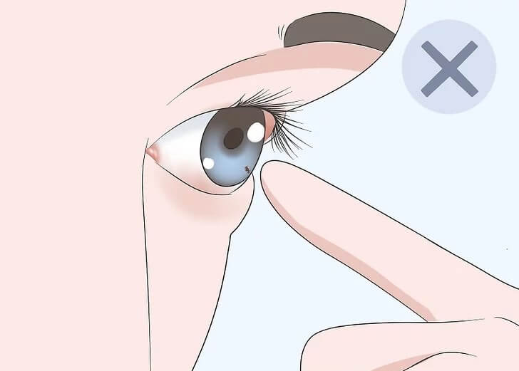 Cách lấy bụi ra khỏi mắt đơn giản