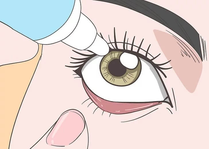 Cách trị bệnh mắt tuyến giáp hiệu quả