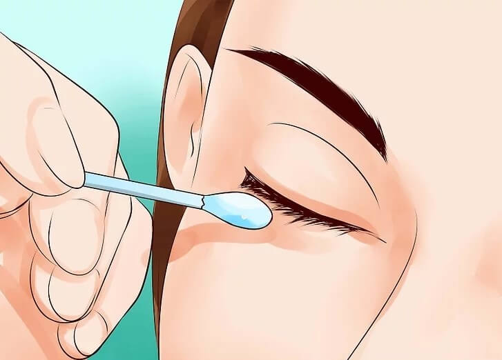 Cách trị đau mắt tại nhà