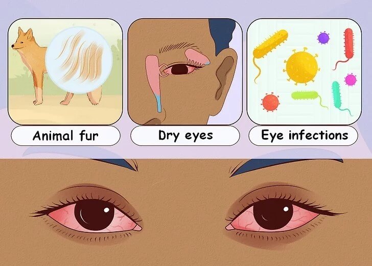 Cách trị ngứa mắt tại nhà hiệu quả