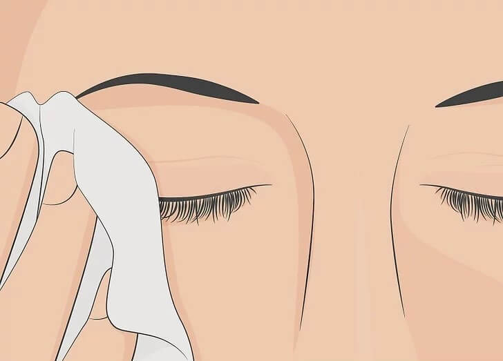 Cách điều trị nhiễm trùng mắt hiệu quả