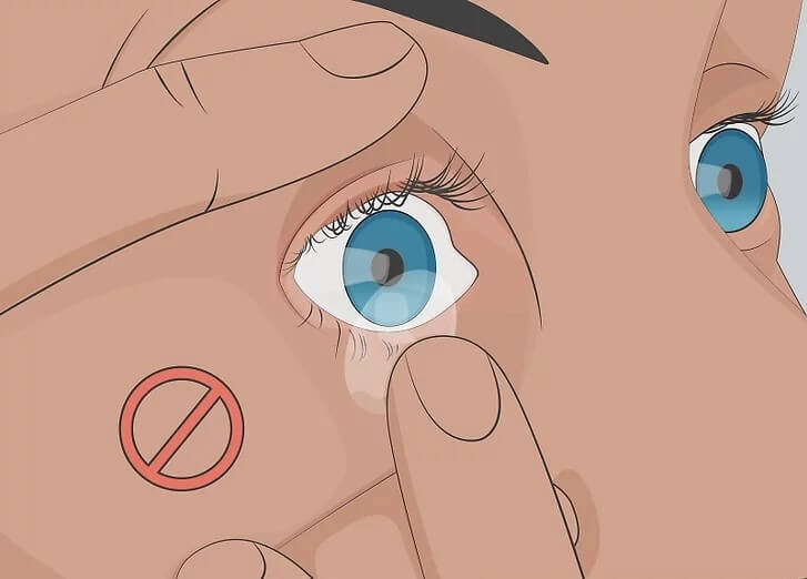 Cách điều trị nhiễm trùng mắt hiệu quả