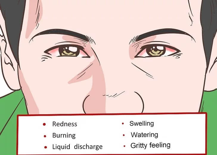 Cách xoa dịu cơn đau và ngứa mắt hiệu quả