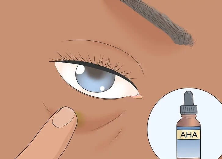 Cách xóa nếp nhăn vùng mắt tại nhà hiệu quả