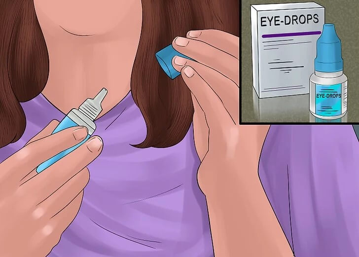 Hướng dẫn sử dụng thuốc mỡ tra mắt