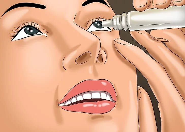 Hướng dẫn sử dụng thuốc mỡ tra mắt