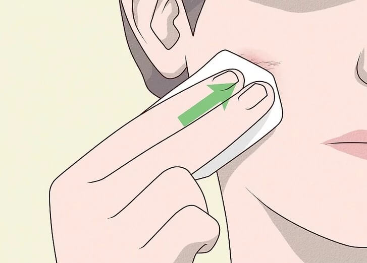Cách trị vết trầy xước trên mặt tại nhà không để lại sẹo