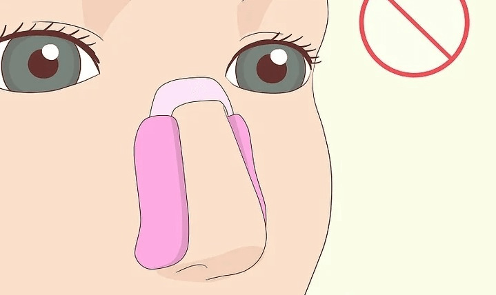 Cách chữa vẹo vách ngăn mũi không cần phẫu thuật