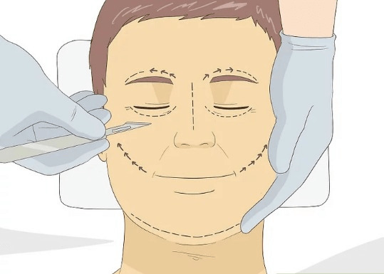 Cách làm căng da mặt tại nhà không cần phẫu thuật