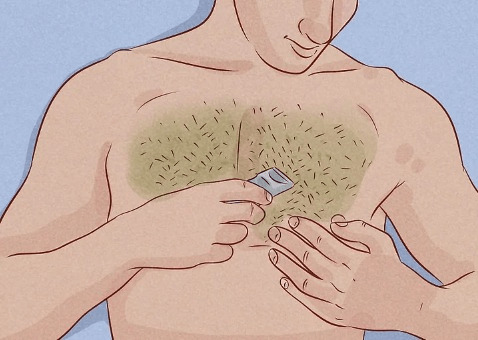 Cách triệt lông vùng ngực vĩnh viễn tại nhà