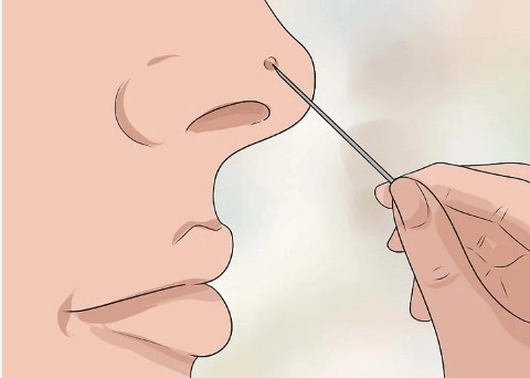  Hướng dẫn cách ngăn ngừa lông mũi mọc ngược hiệu quả