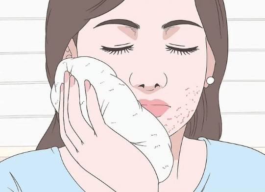 Cách chữa phát ban trên mặt tại nhà
