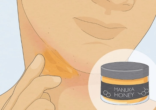 Các biện pháp ngăn ngừa da bị đỏ sau khi wax lông tại nhà